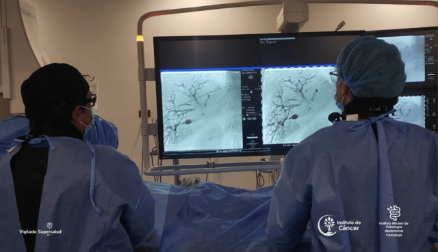 Procedimiento de alta complejidad de doble deprivación venosa hepática para el tratamiento de tumores hepáticos en la Red Hospitalaria Méderi